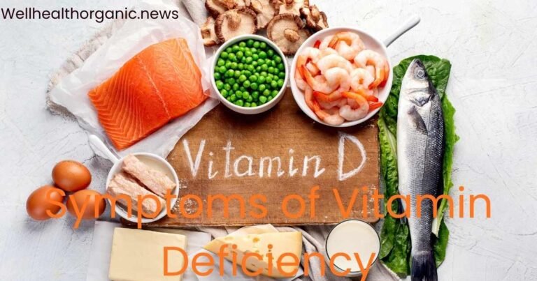 Wellhealthorganic.com Symptoms of Vitamin Deficiency