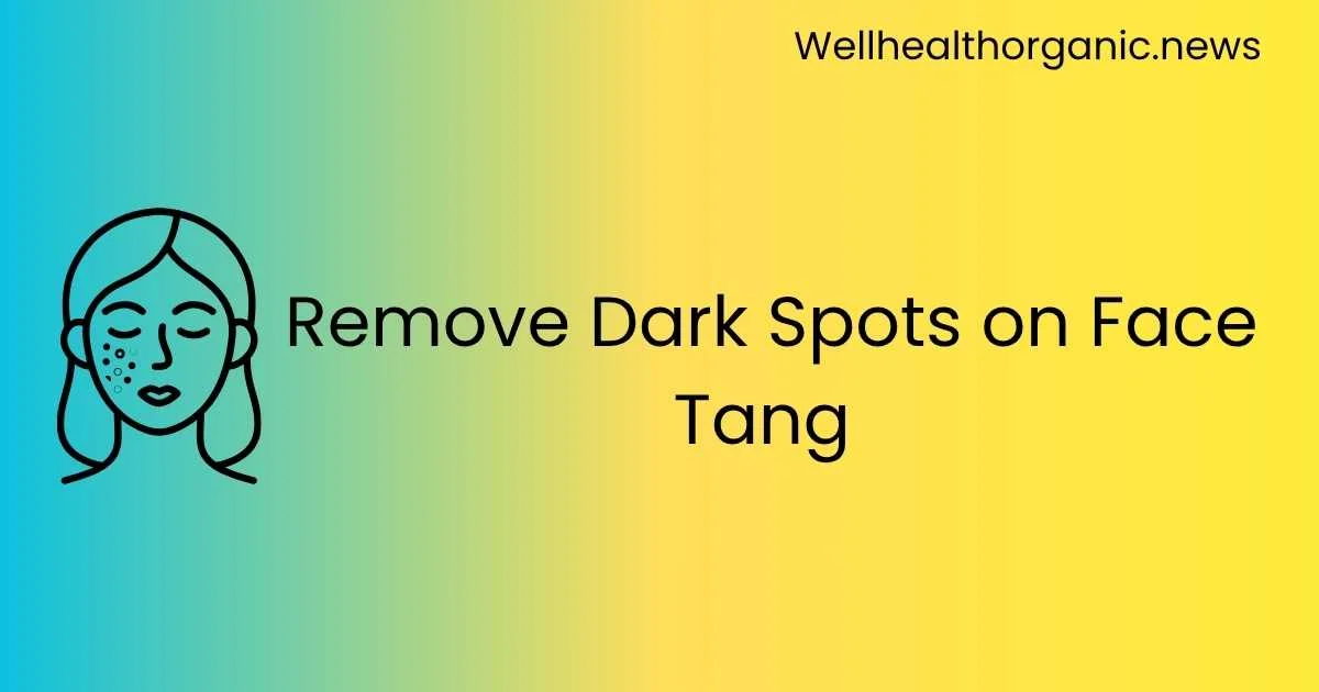 Wellhealthorganic.com : remove dark spots on face tang